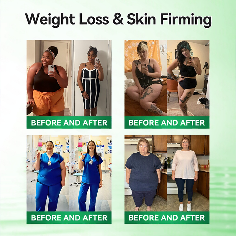 𝑶𝒇𝒇𝒊𝒄𝒊𝒂𝒍 𝑺𝒕𝒐𝒓𝒆  | 👩‍⚕️ H𝐞a𝐥r𝐢z𝐞® 1𝟐-𝐈N-1 M𝐨r𝐢n𝐠a * B𝐞r𝐛e𝐫i𝐧e * N𝐀D+ 𝐀d𝐯a𝐧c𝐞d N𝐚n𝐨 𝐌i𝐜r𝐨n𝐞e𝐝l𝐞 𝐏a𝐭c𝐡 (𝐎𝐧𝐜𝐞 𝐃𝐚𝐢𝐥𝐲, 𝐯𝐢𝐬𝐢𝐛𝐥𝐞 𝐜𝐡𝐚𝐧𝐠𝐞𝐬 𝐢𝐧 𝟕 𝐝𝐚𝐲𝐬）🔥F𝐨r 𝐎𝐛𝐞𝐬𝐢𝐭𝐲, 𝐋o𝐨s𝐞 𝐒k𝐢n, 𝐃𝐢𝐚𝐛𝐞𝐭𝐞𝐬, 𝐒𝐥𝐞𝐞𝐩 𝐀𝐩𝐧𝐞𝐚, 𝐀𝐧𝐝 𝐉𝐨𝐢𝐧𝐭 𝐈𝐬𝐬𝐮𝐞𝐬🥒🎍