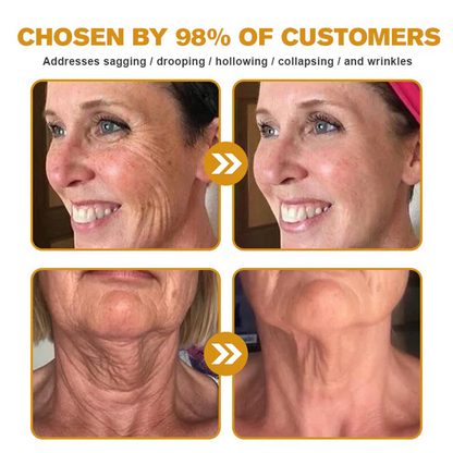 💫🧑‍⚕️InnoMedix® Bee venom Pro Comprehensive Cream —Tightening for Skin Types 🔥