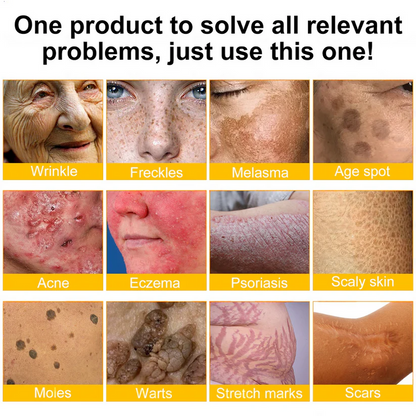 💫🧑‍⚕️InnoMedix® Bee venom Pro Comprehensive Cream —Tightening for Skin Types 🔥