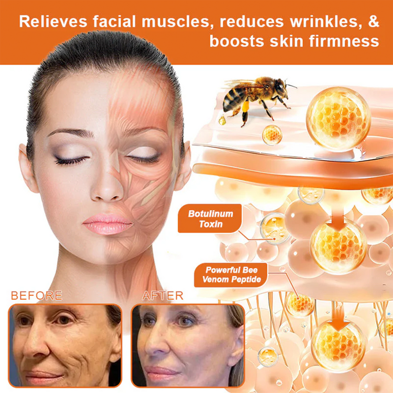 💫🧑‍⚕️InnoMedix® Bee venom Pro Comprehensive Cream —Tightening for Skin Types 🔥