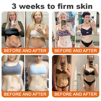 💫🧑‍⚕️InnoMedix® Bee venom Pro Comprehensive Cream —Tightening for Skin Types 🔥