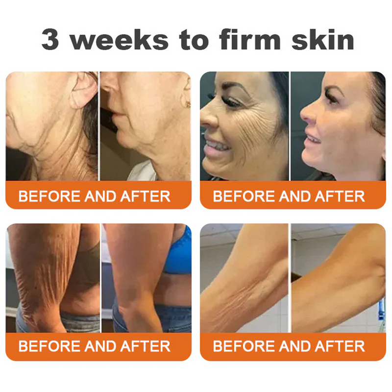 💫🧑‍⚕️InnoMedix® Bee venom Pro Comprehensive Cream —Tightening for Skin Types 🔥