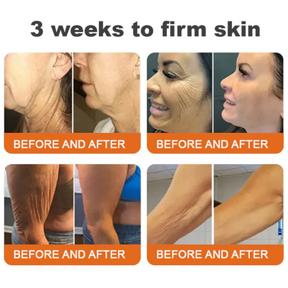 💫🧑‍⚕️InnoMedix® Bee venom Pro Comprehensive Cream —Tightening for Skin Types 🔥
