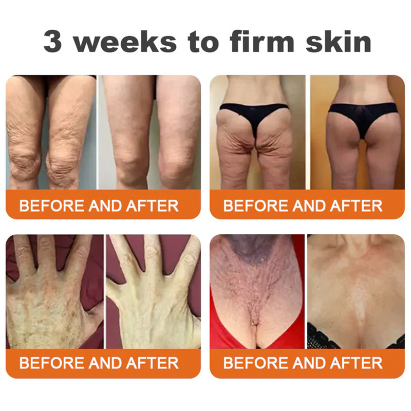 💫🧑‍⚕️InnoMedix® Bee venom Pro Comprehensive Cream —Tightening for Skin Types 🔥